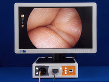 Cargar imagen en el visor de la galería, Cámara laparoscopica Smith & Nephew LENS fuente de luz LED integrada