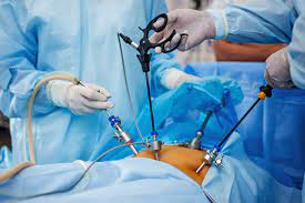 Laparoscopia y Endoscopia